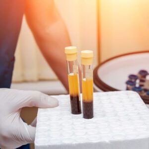 Blut-Stammzellentherapie