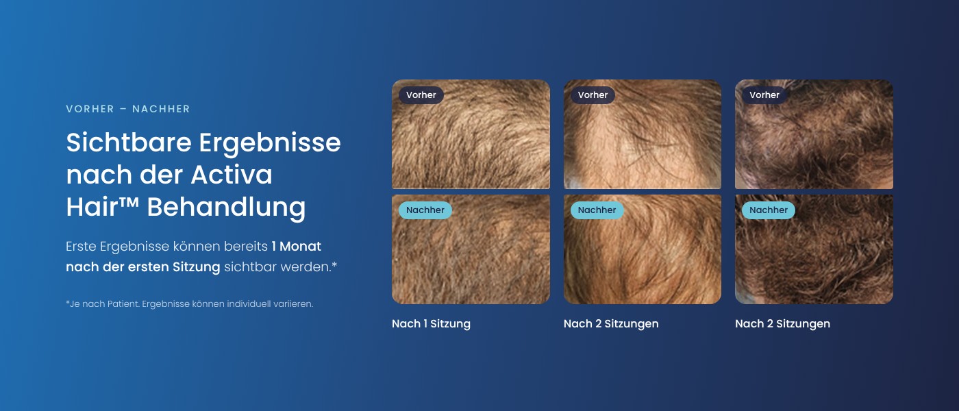 Ergebnisse der Activa Hair Behandlung